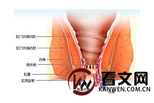 了解痔疮病因,保护肛门健康