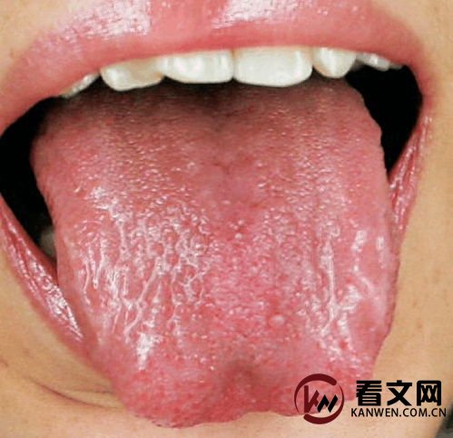 舌头红少苔