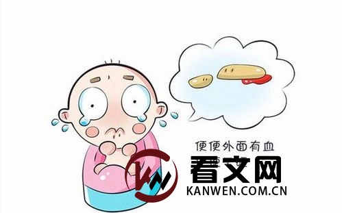 大便鲜红出血？小心这几种原因需引起警惕！