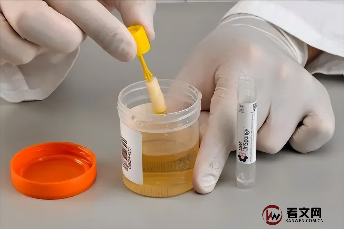 “裤子脱了腿张开”,医院里一个比一个尴尬的体检,你做过几个