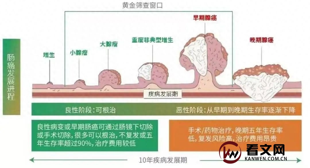 人类又赢了?专家:结直肠癌有望成为第二种被“消灭”的癌症!